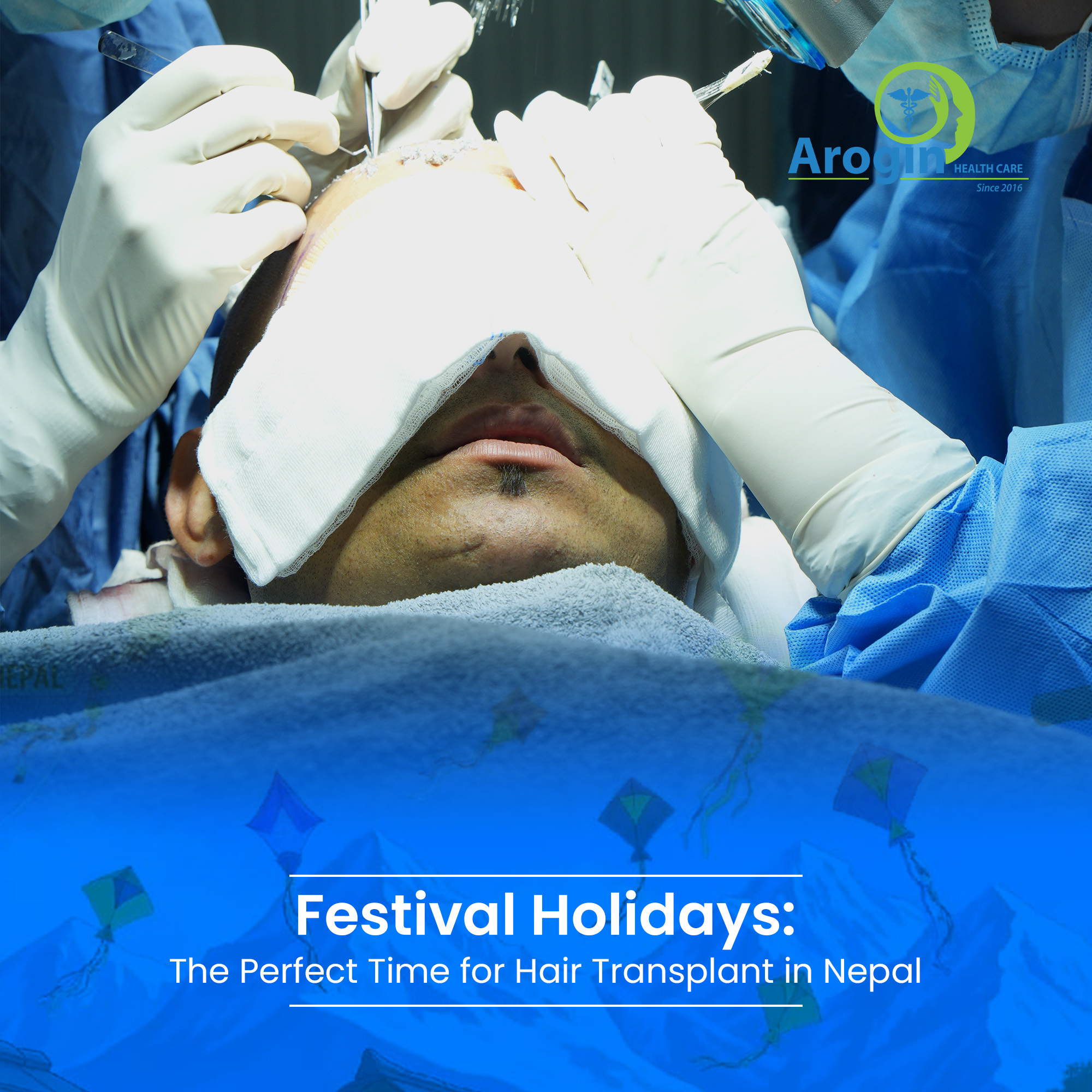 Festival Holidays: The Perfect Time for Hair Transplant in Nepal